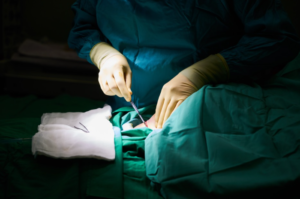 Simple Ways to Find the Best Cosmetic Surgeon