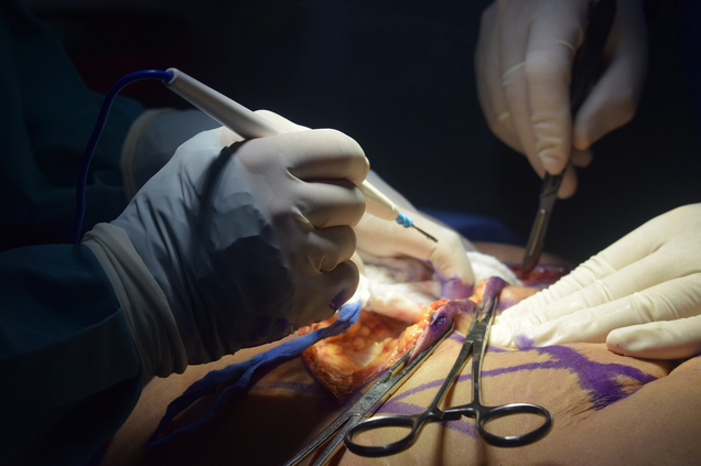 surgery